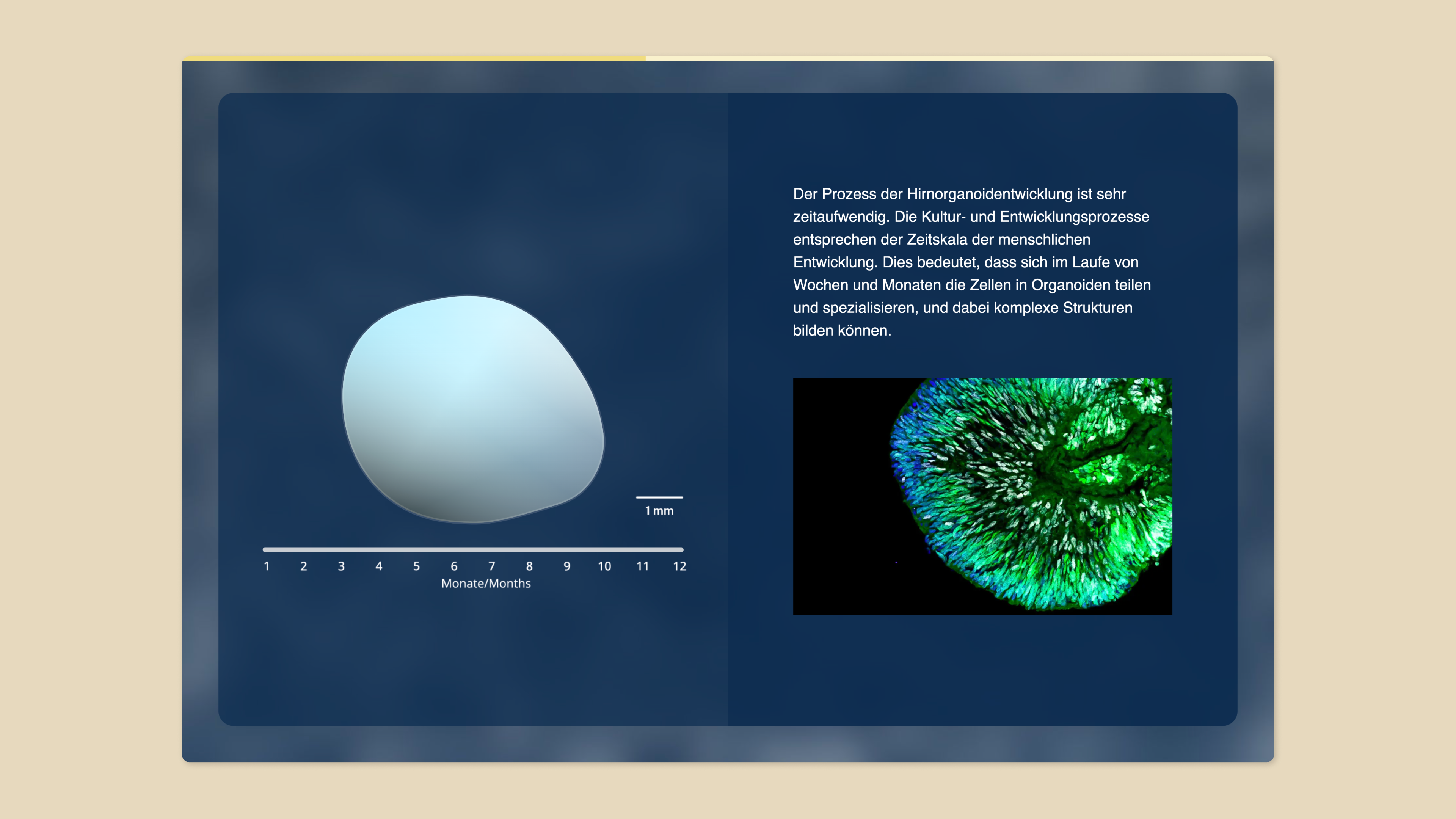 Die Abbildung eines Hirnorganoids auf der linken Seite zeigt sein Wachstum über den Zeitraum von einem Jahr. Auf der rechten Seite erklärt der entsprechende Text, dass das Wachstum eines Hirnorganoids sehr zeitaufwändig ist. Darunter befindet sich eine weitere detaillierte Abbildung eines Hirnorganoids.