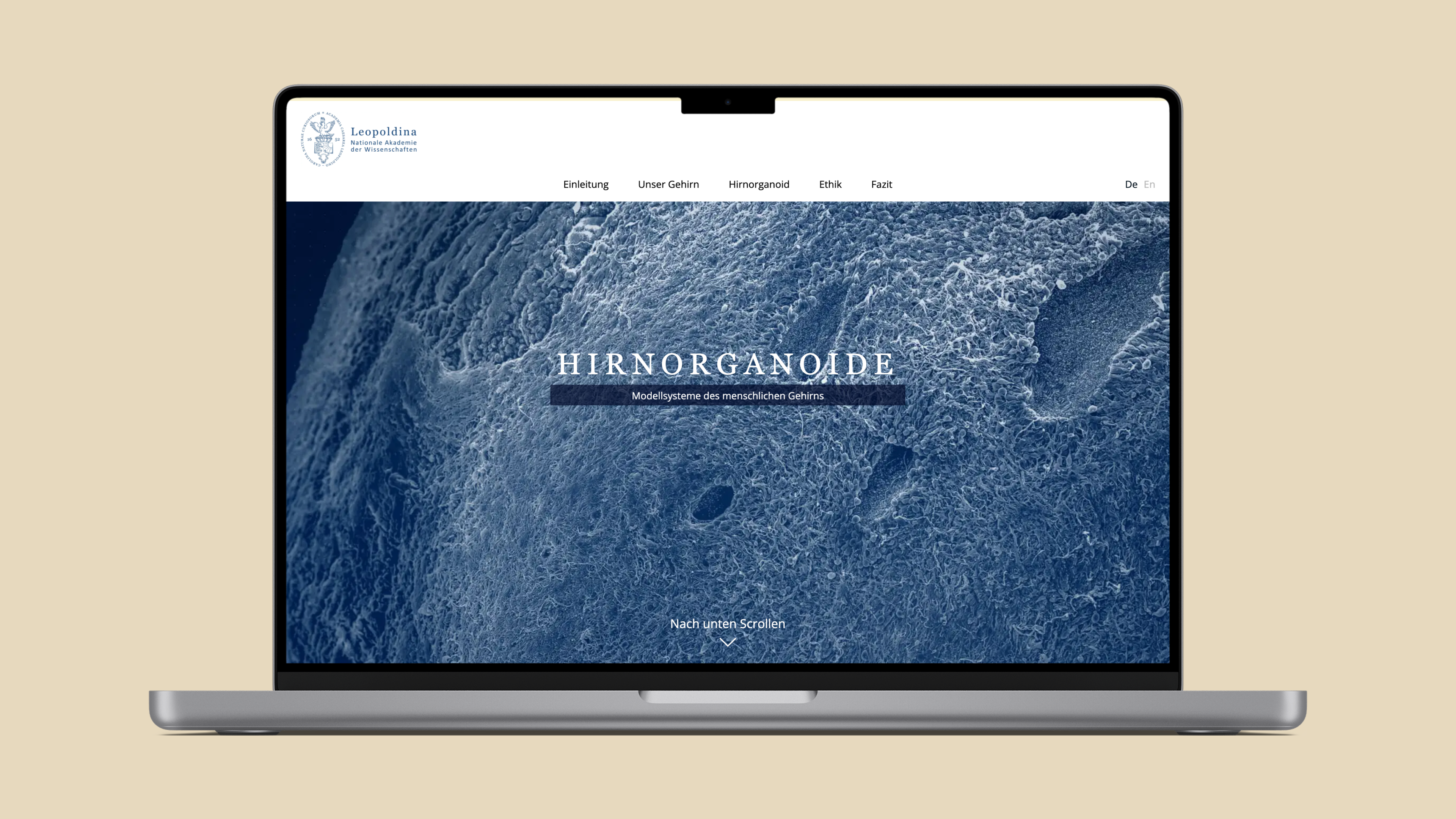 Der Startbildschirm des digitalen Dossiers zum Thema "Hirnorganoide". Der Hintergrund zeigt ein detailliertes Bild eines Hirnorganoids.